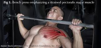 pectis major muscle injuries