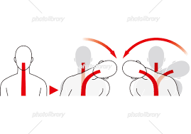 横からの衝撃などによる首の動き むち打ち症 イラスト素材 [ 5811418 ] - フォトライブラリー photolibrary