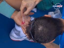 The lefty thing does help, though. Rafael Nadal Dealing With Nasty Blisters On His Hand