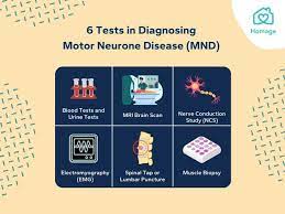 motor neurone disease mnd 101 causes