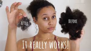 Telogen effluvium is usually a temporary condition that resolves over time. Rice Water Black Tea Rinse Stopped My Hair From Falling Out Immediately Youtube