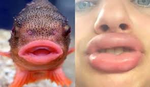 kylie jenner lip challenge continues