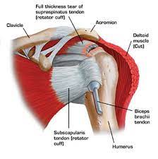 Nyc Shoulder Injuries Treatment Doctor