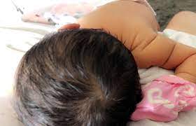 How do i know if my baby has acid reflux? Heartburn Lots Of Hair June 2018 Babies Forums What To Expect