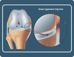 knee ligament injury treatment at st