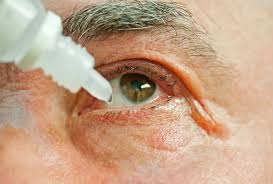 home remes to soothe itchy eyes