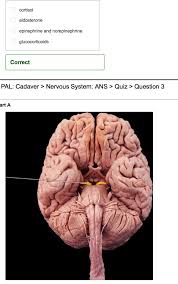 The neuron cell is made up of which of the following parts? Nervous System Quiz Anatomy Anatomy Drawing Diagram