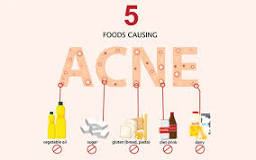 what-foods-cause-acne