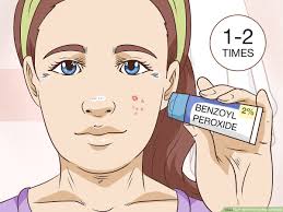 3 ways to painlessly pop a pimple wikihow