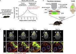 dynamic brain tumor microenvironment
