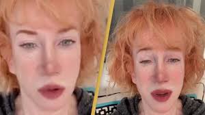 kathy griffin has surgery after losing