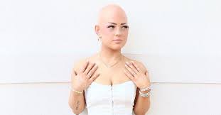 tiktok mua emmy combs talks alopecia