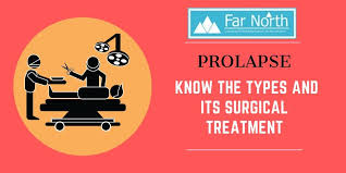 know the types and its surgical treatment