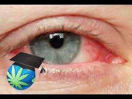 how to get rid of red eyes high