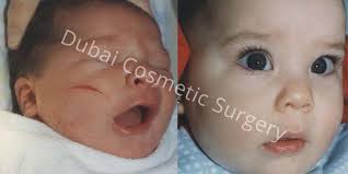 Image result for DUBAI COSMETIC SURGERY