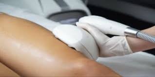 best laser hair removal businesses in