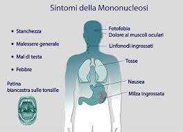 La maggior parte delle volte la mononucleosi è asintomatica: Mononucleosi La Malattia Del Bacio Conoscerla E Combatterla