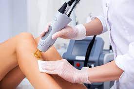 laser hair removal financing canada