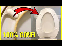 Remove Yellow Stains From Toilet Seat