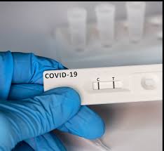 pack of 100 x covid test kits results