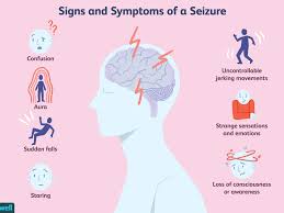 According to nmss, cis refers to a first episode of neurological symptoms that lasts at least 24 hours and is caused by inflammation or demyelination. Seizures And Epilepsy In Multiple Sclerosis