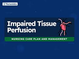 ineffective tissue perfusion nursing