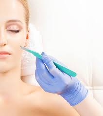 dermaplaning benefits what to expect