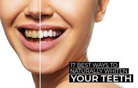 This was a staple in my teeth whitening regimen the. 17 Home Remedies For Teeth Whitening Treatment And Tips