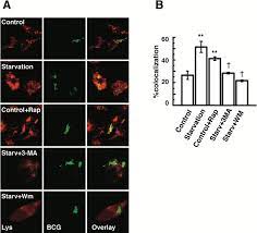 Autophagy Is A Defense Mechanism