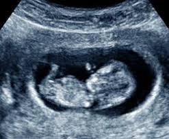 Ssw liegt in der mitte des dritten schwangerschaftsmonats und leitet das ende der. Schwanger Ihr Baby 8 Wochen Alt Ssw 10 Babywelten Ch