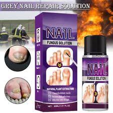 zetaclear natural safe nail fungus