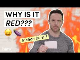 is it friction burn or something more