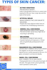 skin cancer types basal cell
