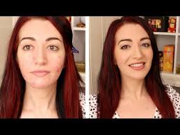 acne e skin tutorial