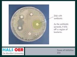 Microbiology Resources How To Measure Zones Of Inhibition Zoi
