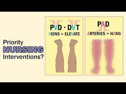 Pad Vs Pvd Top 2 Tested Nursing Treatments Memory Tricks