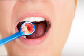 a periodontist may treat severe gum disease