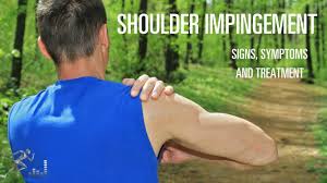 exercises for shoulder impingement to