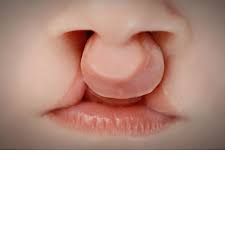 cleft lip and cleft palate in turkey