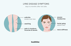 what-are-the-3-stages-of-lyme-disease