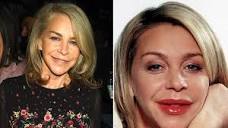 Leslie Ash issues stark warning to young women over lip fillers ...