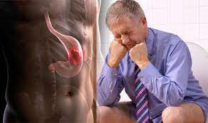 One of the early symptoms of stomach cancer is a pain in the stomach area or under the breastbone. Stomach Cancer Symptoms And Signs Dark Almost Black Poo Could Indicate The Disease Express Co Uk