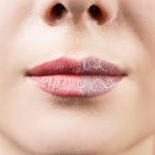 lips kissing sos serum skincare