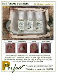 perfect feet nail fungus treatment be