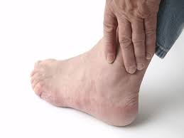 home remes to treat pain caused by gout