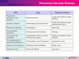 Peripheral Arterial Disease Ppt Download