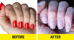 How To Grow Your Nails gambar png