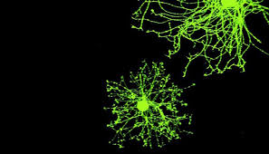 Resultado de imagen de El impulso nervioso viaja a lo largo del axÃ³n de la cÃ©lula del cerebro