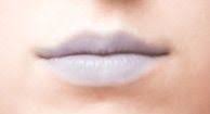 blue lips causes photos and treatments