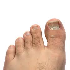 ingrown toenails cause red swollen